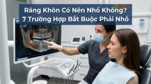 Visual illustration of răng khôn có nên nhổ không