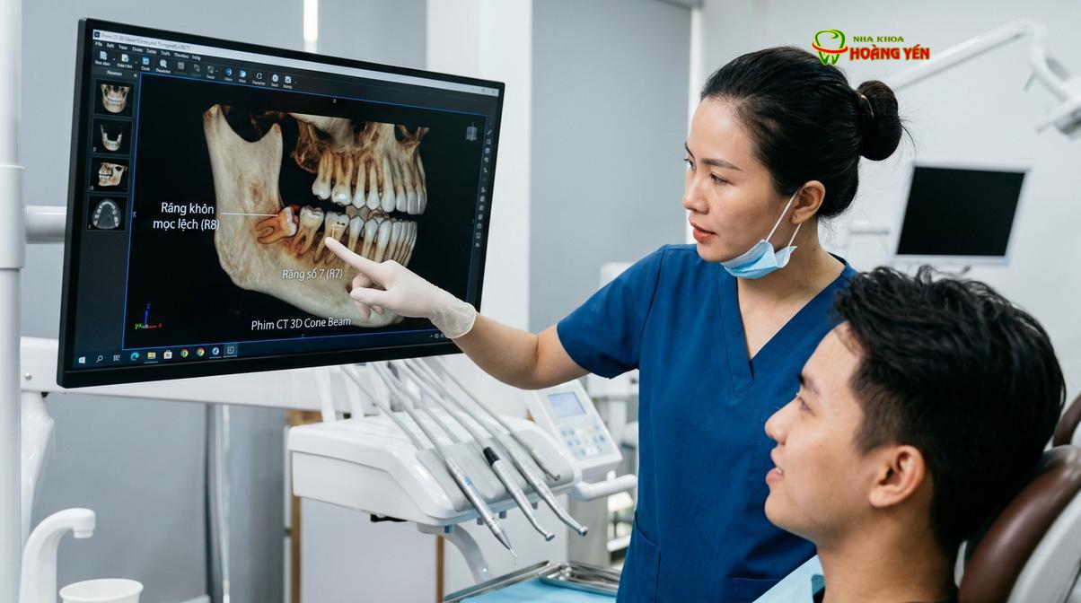 Bác sĩ phân tích phim CT Cone Beam 3D để đánh giá mức độ đâm lệch của răng khôn.