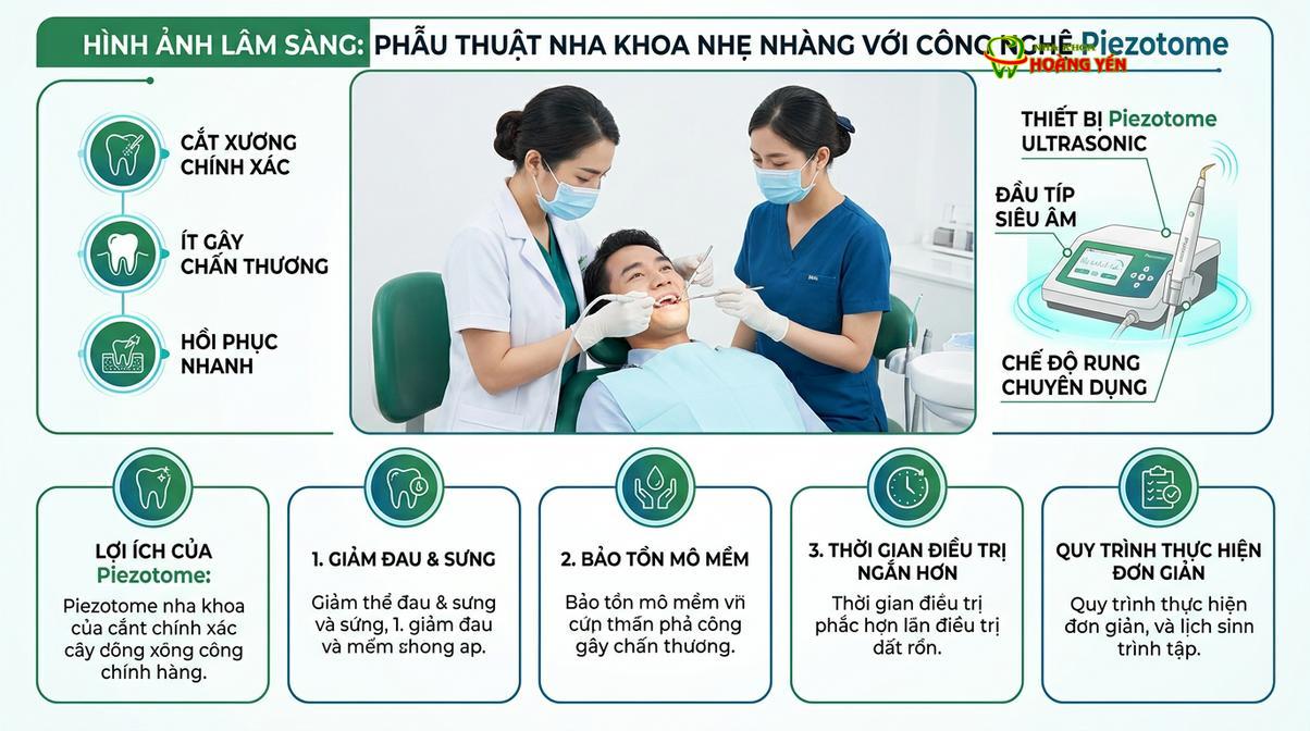 Ứng dụng máy siêu âm Piezotome giúp quá trình nhổ răng khôn diễn ra nhẹ nhàng, ít sang chấn.