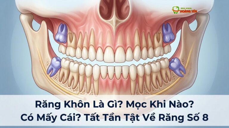 Răng Khôn Là Gì? Mọc Khi Nào? Có Mấy Cái? Tất Tần Tật Về Răng Số 8