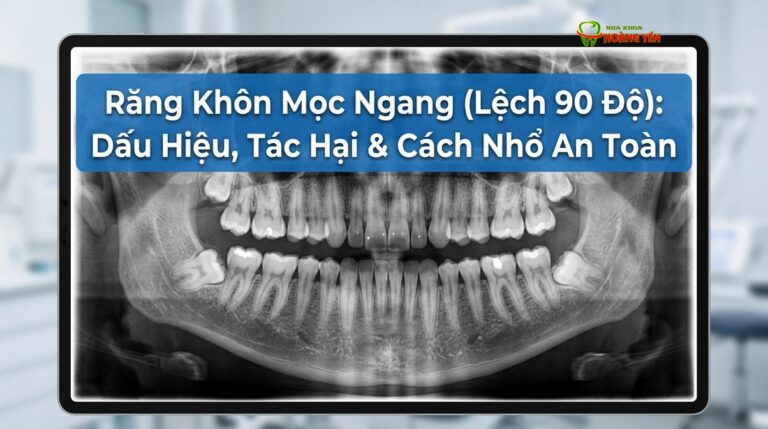 Răng Khôn Mọc Ngang (Lệch 90 Độ): Dấu Hiệu, Tác Hại & Cách Nhổ An Toàn
