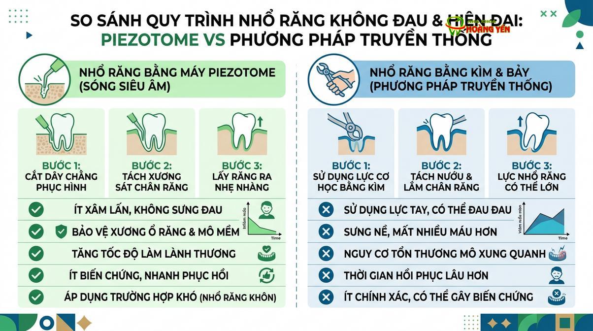 So sánh kỹ thuật nhổ răng truyền thống và công nghệ siêu âm Piezotome.