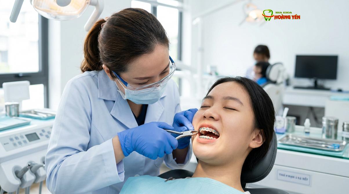 Bác sĩ tiến hành thay dây cung và điều chỉnh lực kéo tại nha khoa.