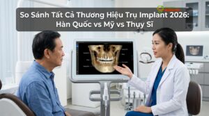 Visual illustration of so sánh trụ implant