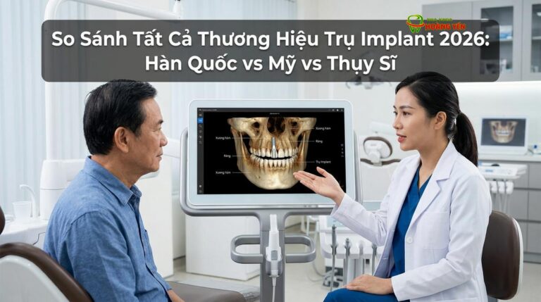 So Sánh Tất Cả Thương Hiệu Trụ Implant: Hàn Quốc vs Mỹ vs Thụy Sĩ