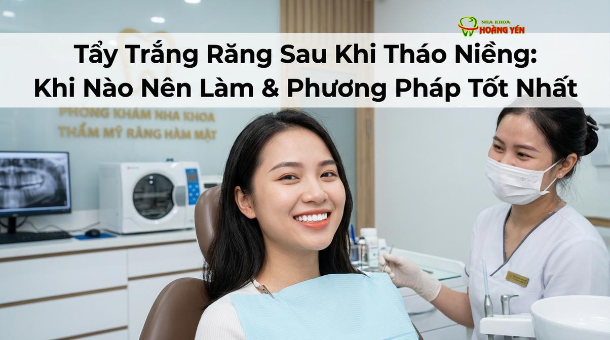 Nụ cười đều đặn và trắng sáng sau khi hoàn tất quá trình chỉnh nha và tẩy trắng răng.