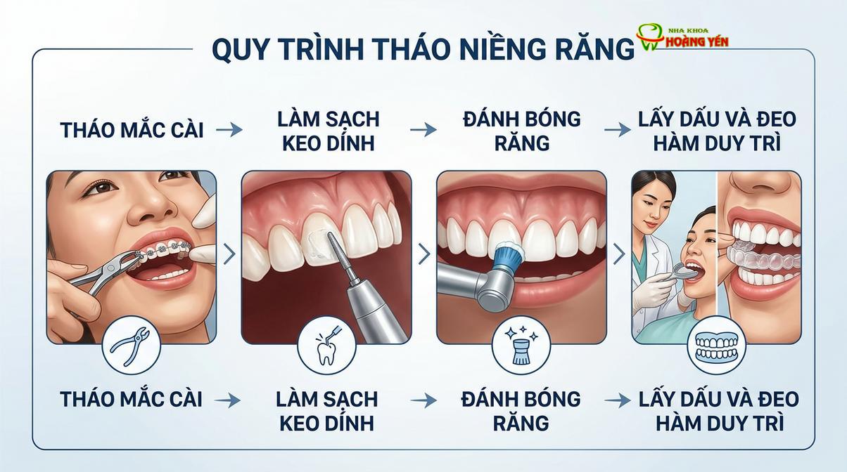 Tóm tắt các bước cơ bản trong quy trình tháo khí cụ chỉnh nha chuẩn y khoa.