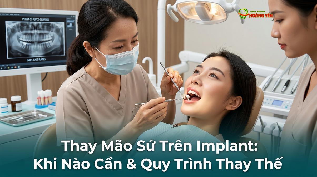 Bác sĩ thăm khám và đánh giá tình trạng mão sứ trên implant của bệnh nhân.