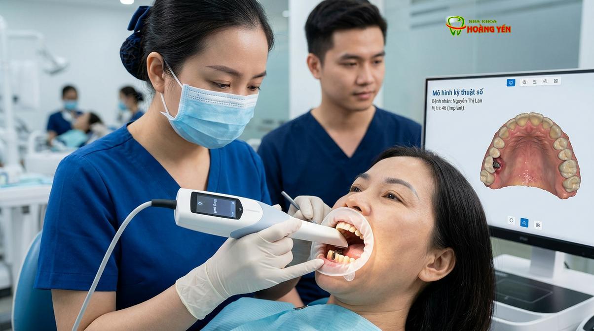 Lấy dấu răng kỹ thuật số giúp chế tác mão sứ mới với độ chính xác cao.