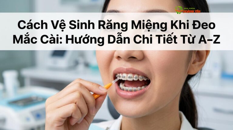 Cách Vệ Sinh Răng Miệng Khi Đeo Mắc Cài: Hướng Dẫn Chi Tiết Từ A–Z