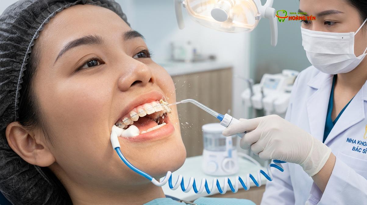Máy tăm nước sử dụng áp lực tia nước để đẩy bật thức ăn thừa tại các vị trí khó tiếp cận.