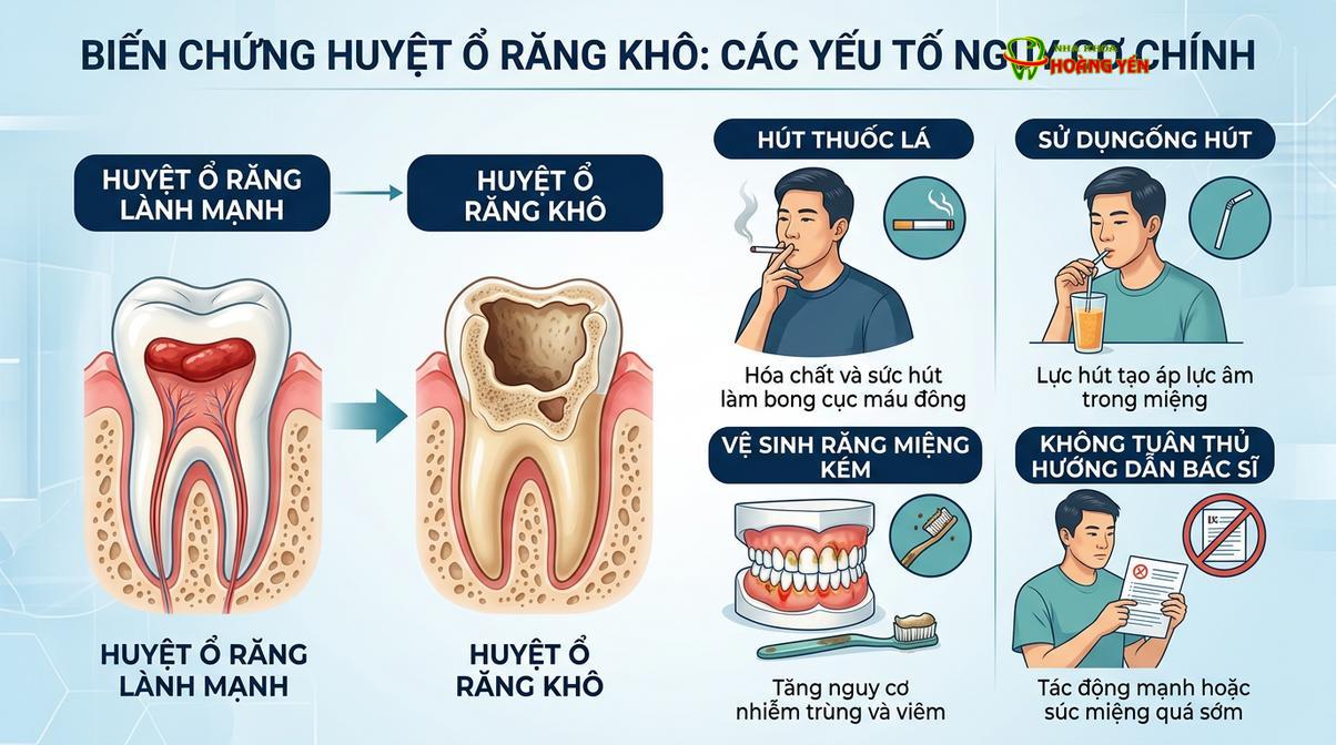 Các yếu tố nguy cơ hàng đầu dẫn đến tình trạng mất cục máu đông sau phẫu thuật.